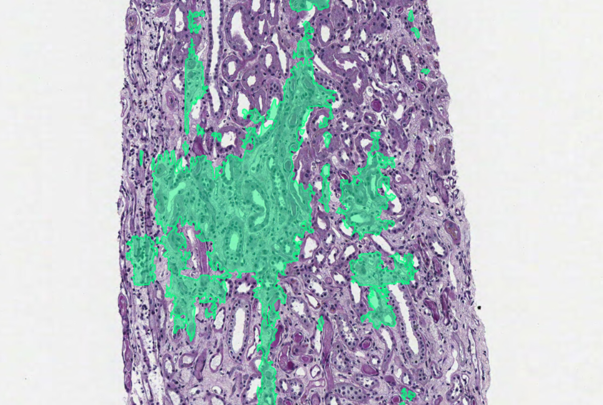 IFTA Segmentation